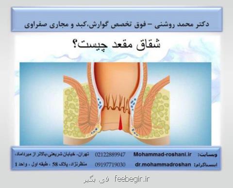 آندوسكوپی معده